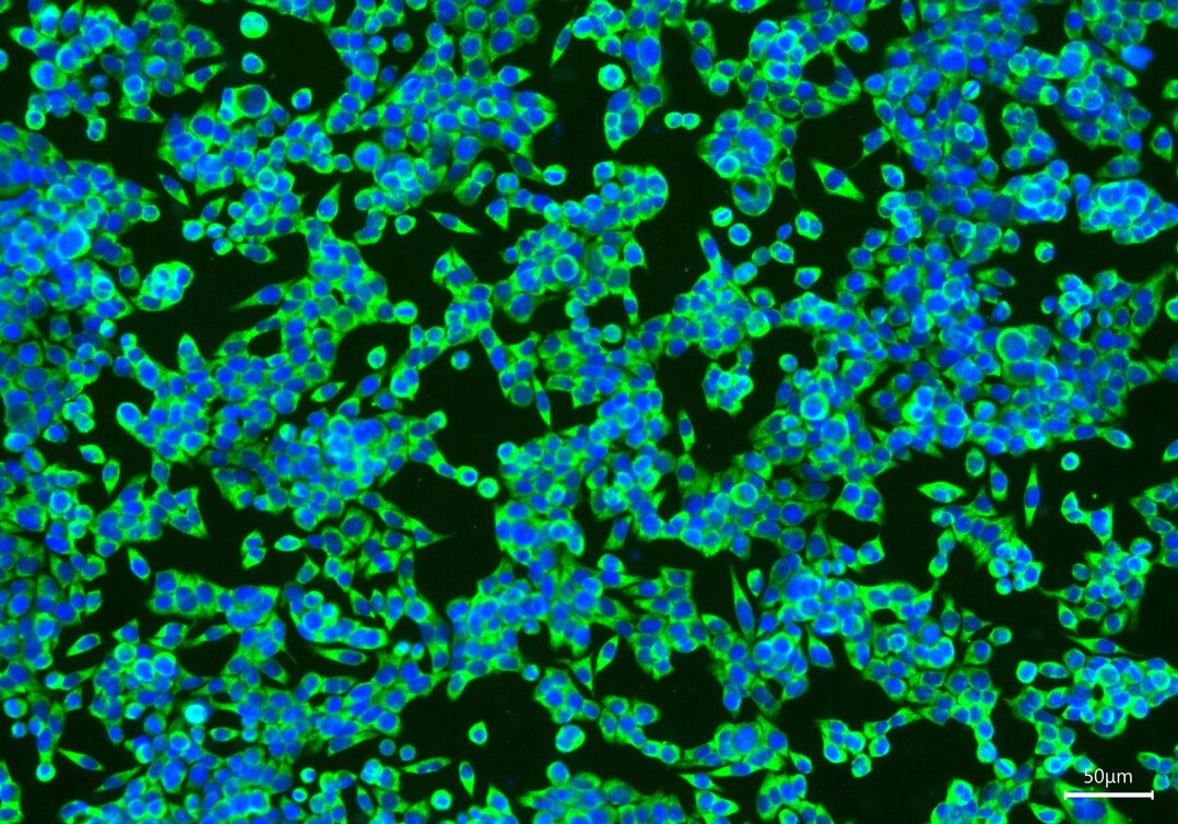 Fluoreszenzmikroskopische Aufnahme kolorektaler Karzinomzellen (CRC) mit DAPI-gefärbten Zellkernen (blau, 460 nm) und Aktin-Zytoskelett (grün, 488 nm).